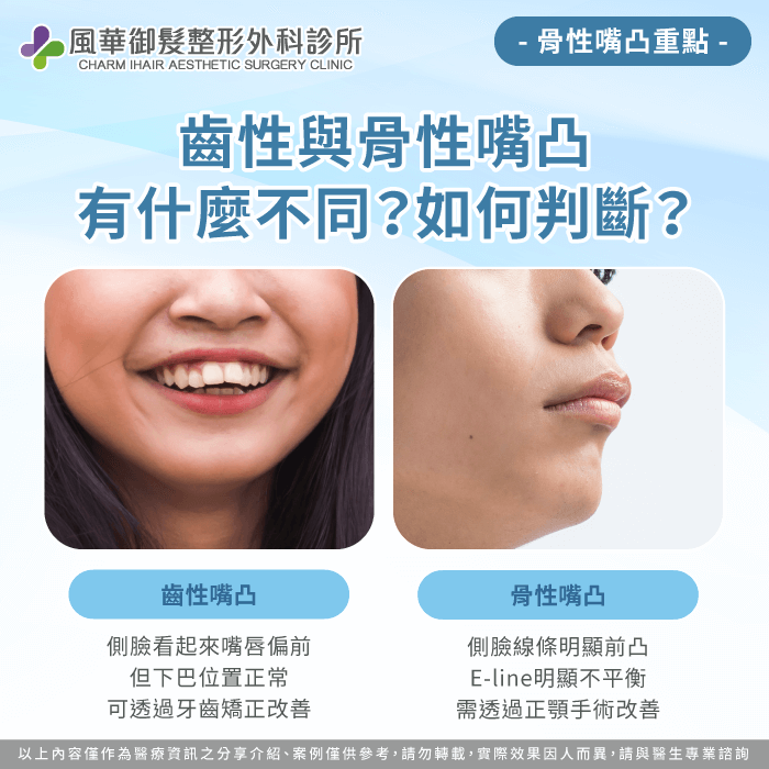 齒性與骨性嘴凸有什麼不同-嘴凸正顎