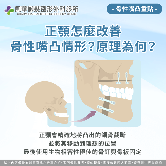 正顎怎麼改善骨性嘴凸-嘴凸正顎