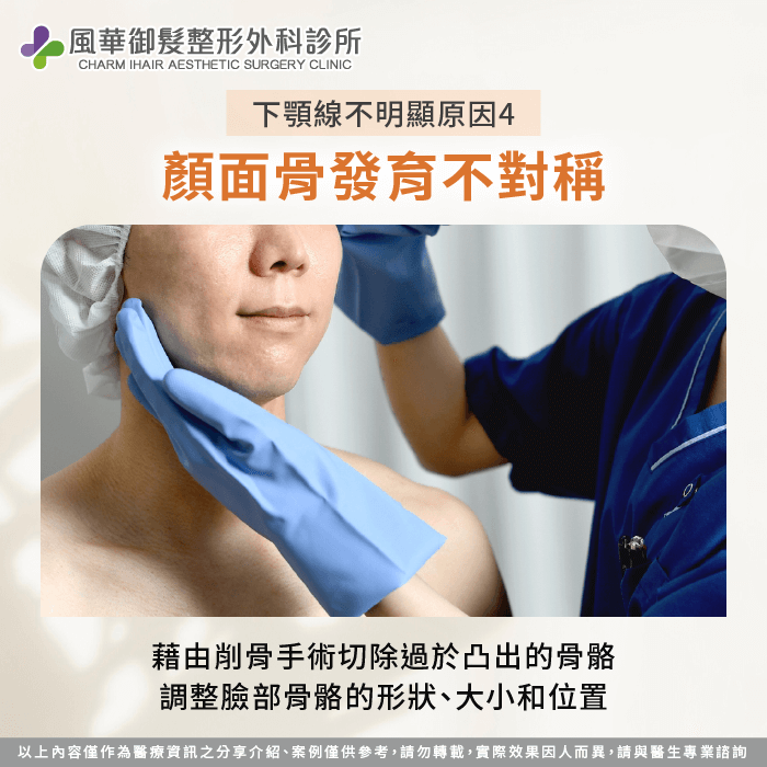 削骨手術切除過度凸出的骨骼,重塑臉部比例,打造俐落下顎線 顏面骨發育不對稱-下顎線不好看