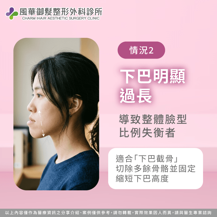 下巴明顯過長適合下巴截骨手術介紹 下巴太長截骨-新竹削骨推薦