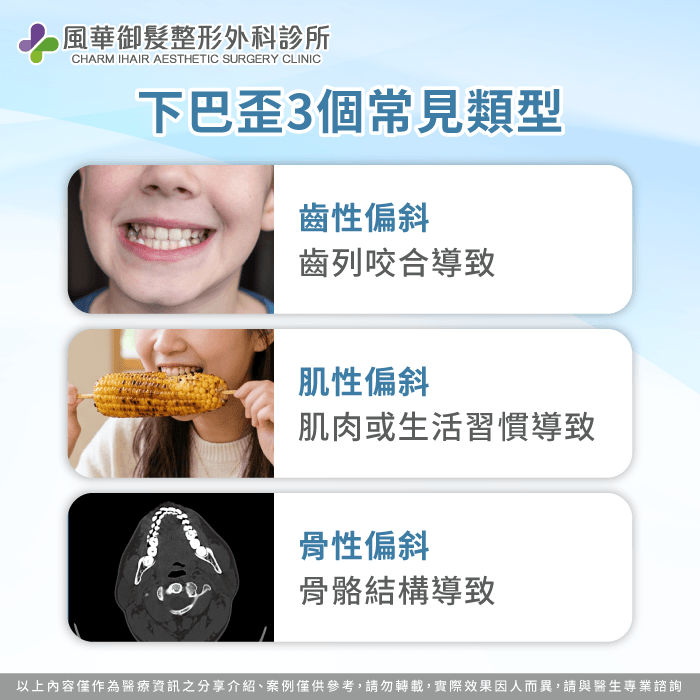 釐清下巴歪偏斜類型:齒性、肌性與骨性結構 下巴歪的類型-下巴歪一定要正顎嗎