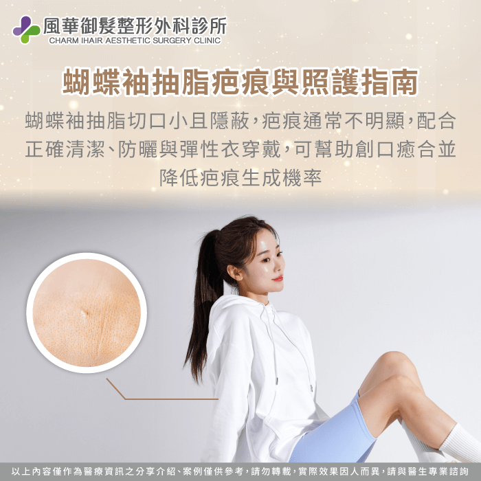 蝴蝶袖抽脂切口小且疤痕位置不明顯,搭配正確術後照護,有助於降低疤痕存在感 蝴蝶袖抽脂疤痕與照護指南-蝴蝶袖可以抽脂嗎