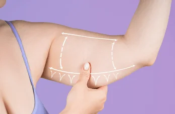 新竹手臂抽脂-新竹手臂抽脂推薦