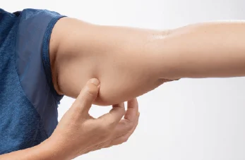 新竹手臂抽脂推薦-新竹手臂抽脂手術