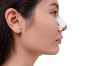 新竹自體肋骨隆鼻手術-新竹自體肋骨隆鼻