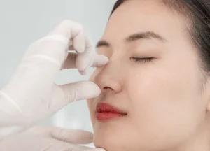 新竹自體肋骨隆鼻手術-新竹自體肋骨隆鼻