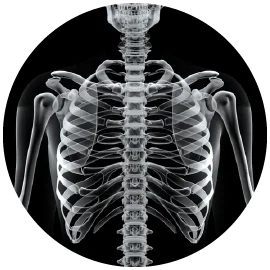 肋骨墊下巴手術-新竹墊下巴手術