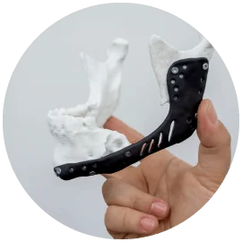 骨水泥墊下巴手術-新竹墊下巴手術推薦