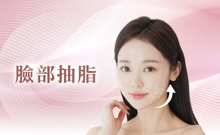 新竹雙下巴抽脂-新竹臉部抽脂推薦