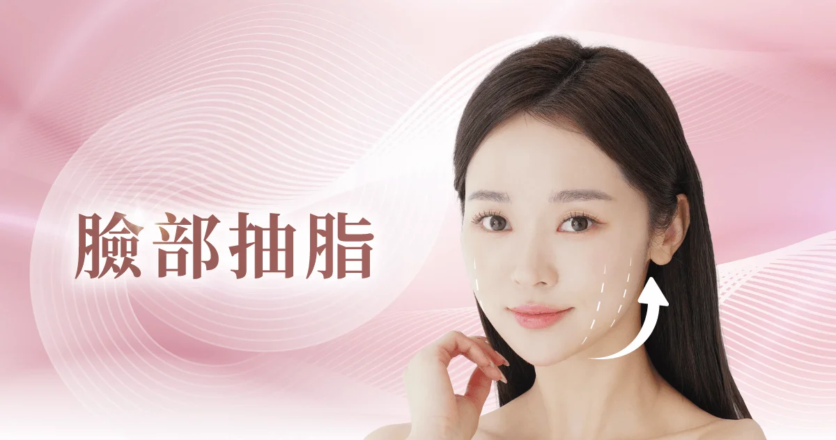 新竹雙下巴抽脂-新竹臉部抽脂推薦