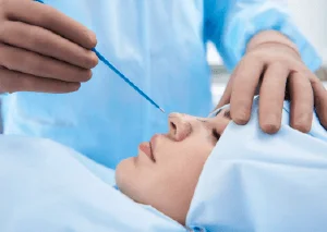 鼻翼縮小手術推薦-新竹鼻翼手術