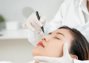 鼻翼縮小手術推薦-新竹鼻翼手術