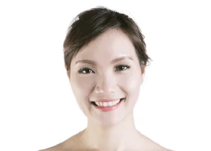 鼻翼縮小手術-新竹鼻翼手術推薦