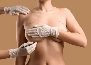 新竹產後提乳推薦-新竹產後提乳