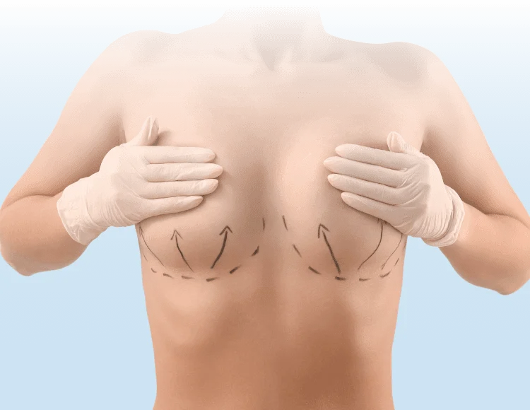 新竹產後提乳推薦-新竹產後提乳