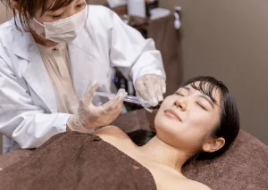 新竹臉部埋線-新竹鼻唇溝填補推薦