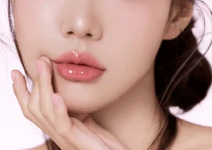 新竹臉部埋線-新竹鼻唇溝填補