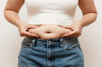 水桶腰抽脂-新竹腰腹抽脂